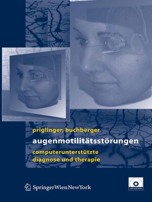 cover image of Augenmotilitätsstörungen